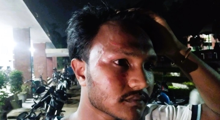 খেলা দেখতে গিয়ে মারধরের শিকার শিক্ষার্থী